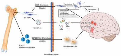 Regulatory Roles of Bone in Neurodegenerative Diseases